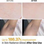 How to use Dr.Melaxin Kojic Acid Turmeric Body Spray – spray on dry skin, gently rub and rinse; for back, elbows, chest, underarms and buttocks