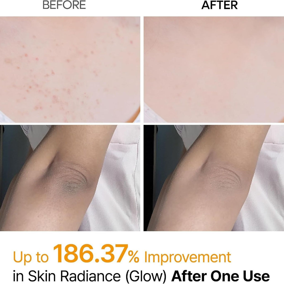 How to use Dr.Melaxin Kojic Acid Turmeric Body Spray – spray on dry skin, gently rub and rinse; for back, elbows, chest, underarms and buttocks