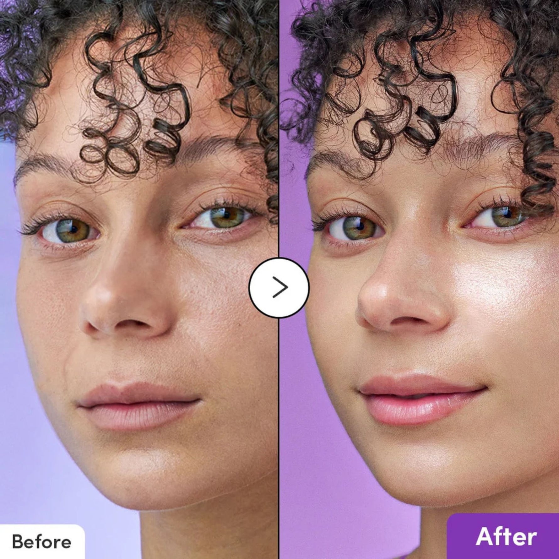 Before and after results using Eqqualberry Bakuchiol Plumping Serum — visibly smoother, brighter, and plumper skin with reduced fine lines