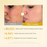 Before and after results of Medicube Kojic Acid Turmeric Resurfacing Toner showing improvement in uneven skin tone, rough texture, and dull-looking skin