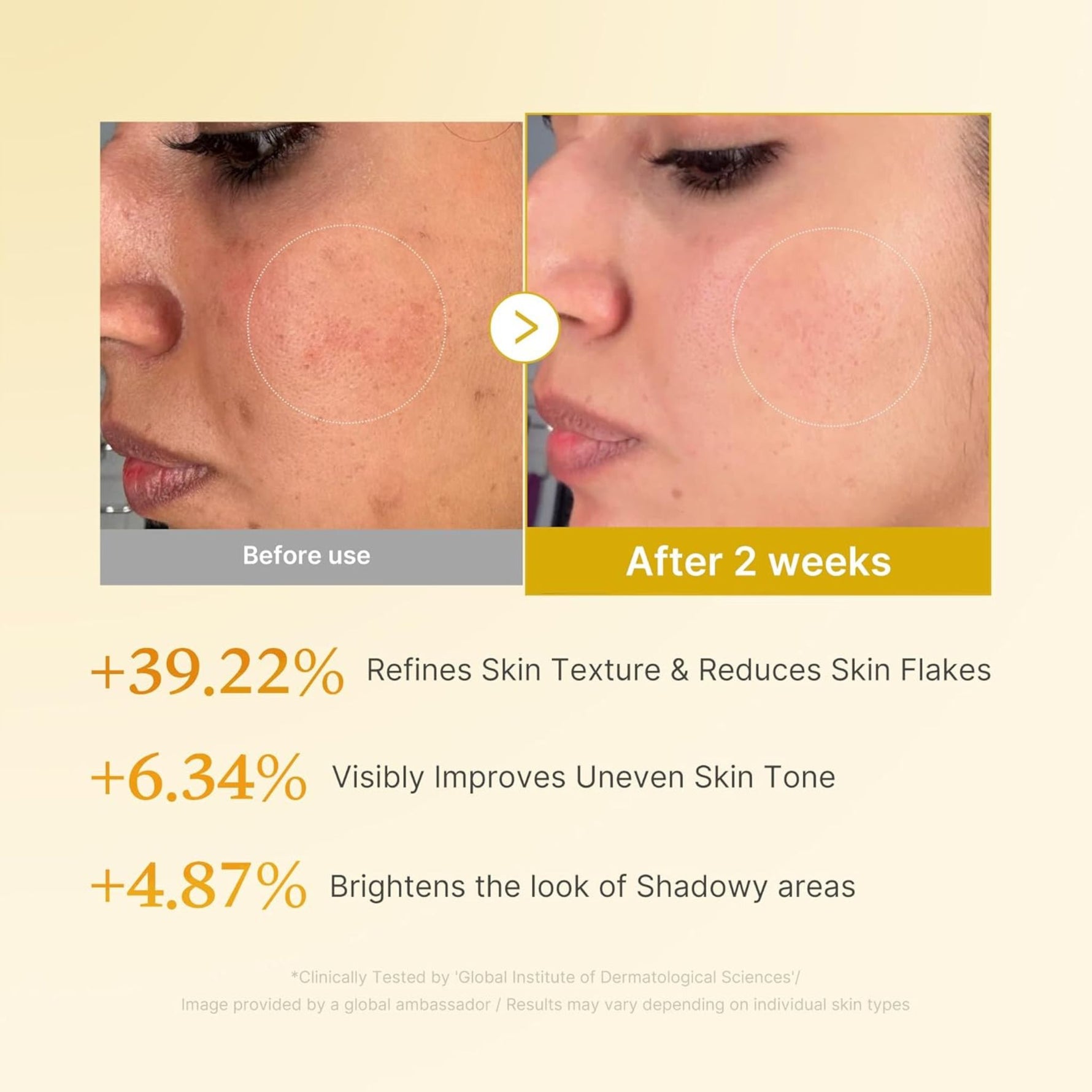 Before and after results of Medicube Kojic Acid Turmeric Resurfacing Toner showing improvement in uneven skin tone, rough texture, and dull-looking skin