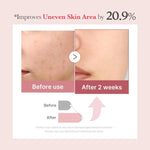 Medicube PDRN Pink Collagen Exosome Shot 7500 before and after results showing improvement in uneven skin tone and dark spots after 2 weeks